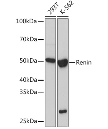 Renin Rabbit Monoclonal Antibody