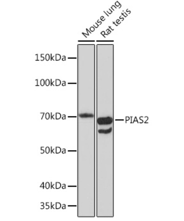 PIAS2 Rabbit Monoclonal Antibody