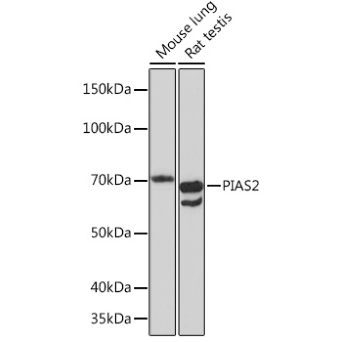 PIAS2 Rabbit Monoclonal Antibody