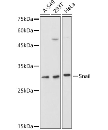 Snail Rabbit Polyclonal Antibody
