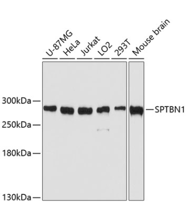 SPTBN1 Rabbit Polyclonal Antibody