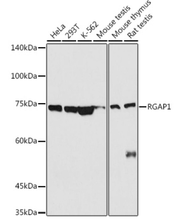 RGAP1 Rabbit Polyclonal Antibody