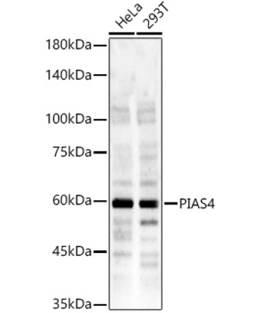 PIAS4 Rabbit Polyclonal Antibody