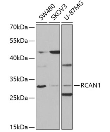 RCAN1 Rabbit Polyclonal Antibody