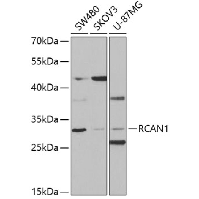 RCAN1 Rabbit Polyclonal Antibody