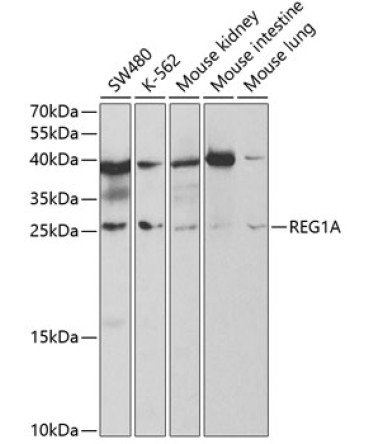 REG1A Rabbit Polyclonal Antibody
