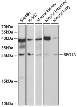 REG1A Rabbit Polyclonal Antibody