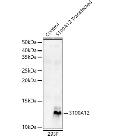 S100A12 Rabbit Polyclonal Antibody