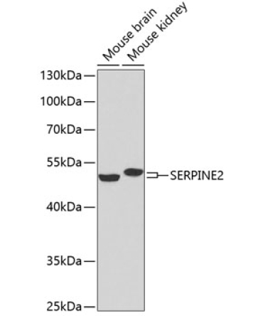 SERPINE2 Rabbit Polyclonal Antibody