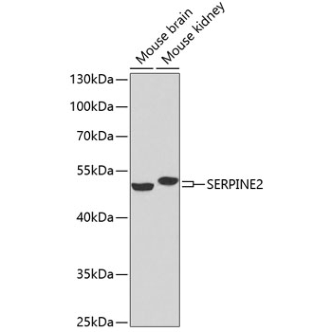SERPINE2 Rabbit Polyclonal Antibody