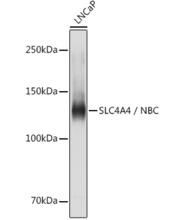 SLC4A4 / NBC Rabbit Polyclonal Antibody