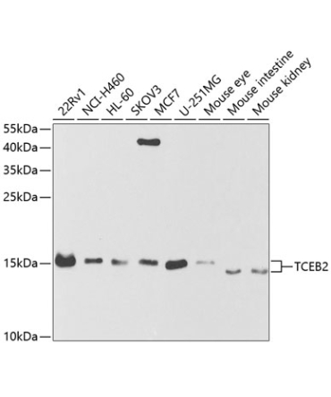 TCEB2 Rabbit Polyclonal Antibody