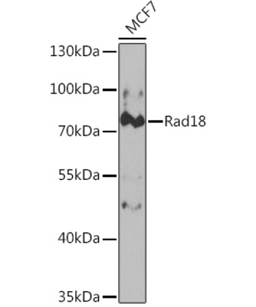 Rad18 Rabbit Polyclonal Antibody