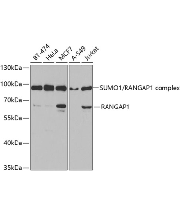 RanGAP1 Rabbit Polyclonal Antibody