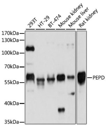 PEPD Rabbit Polyclonal Antibody