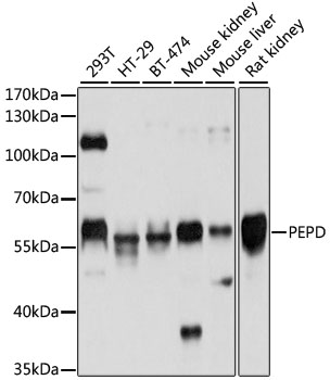 PEPD Rabbit Polyclonal Antibody