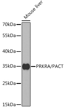 PRKRA/PACT Rabbit Polyclonal Antibody