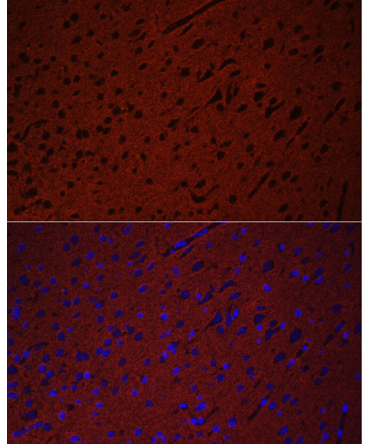 STXBP1 Rabbit Polyclonal Antibody