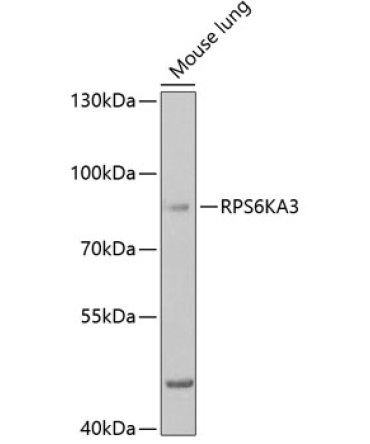 RPS6KA3 Rabbit Polyclonal Antibody
