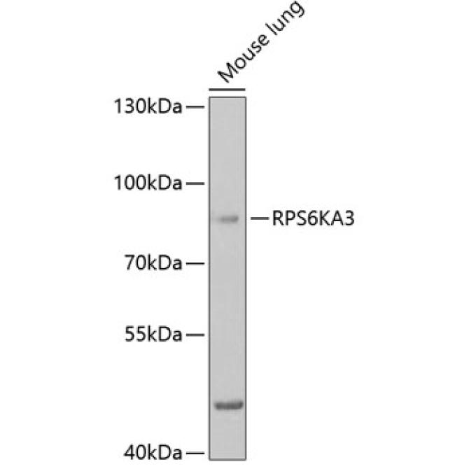 RPS6KA3 Rabbit Polyclonal Antibody