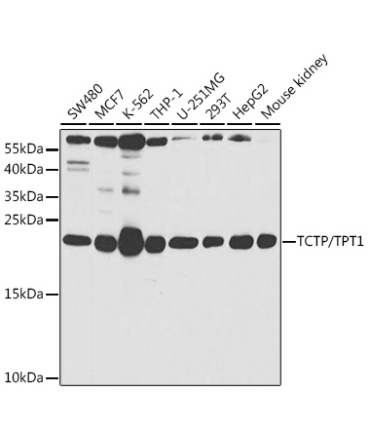 TCTP/TPT1 Rabbit Polyclonal Antibody