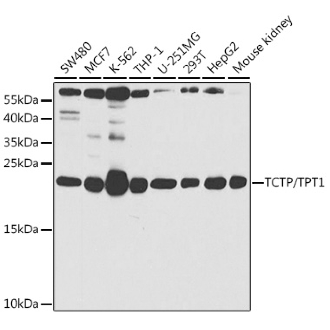 TCTP/TPT1 Rabbit Polyclonal Antibody