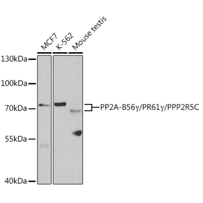 PP2A-B56Gamma/PR61Gamma/PPP2R5C Rabbit Polyclonal Antibody