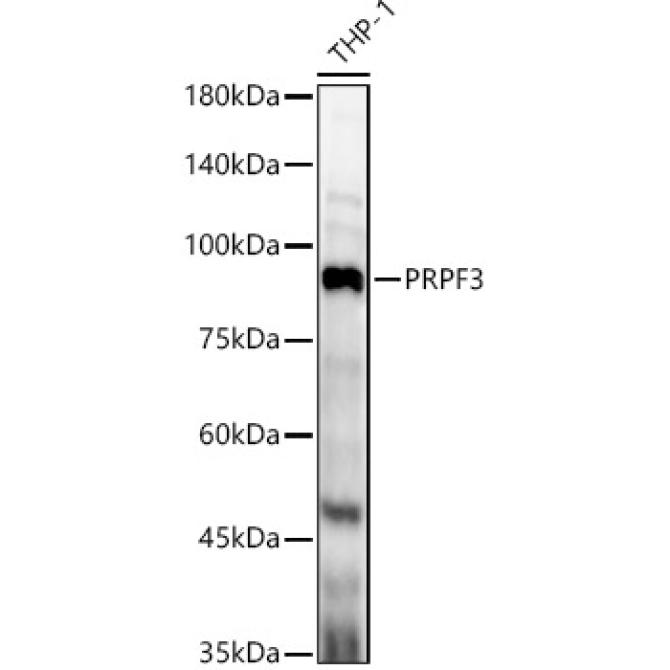 PRPF3 Rabbit Polyclonal Antibody