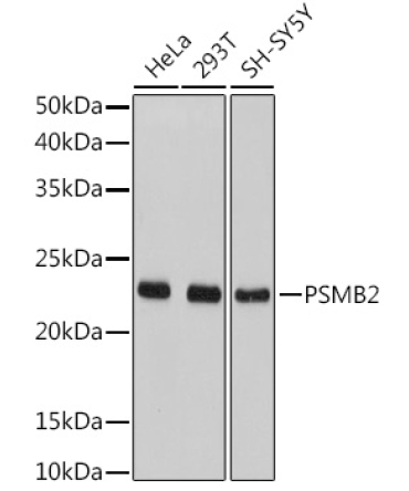 PSMB2 Rabbit Polyclonal Antibody