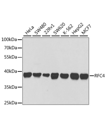 RFC4 Rabbit Polyclonal Antibody