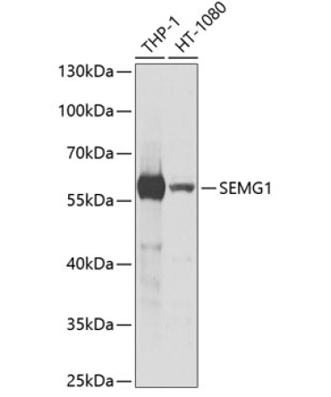 SEMG1 Rabbit Polyclonal Antibody