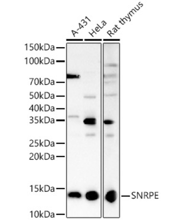SNRPE Rabbit Polyclonal Antibody