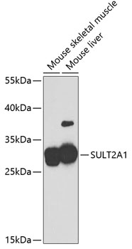 SULT2A1 Rabbit Polyclonal Antibody