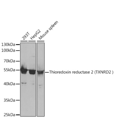 Thioredoxin reductase 2 (TXNRD2 ) Rabbit Polyclonal Antibody