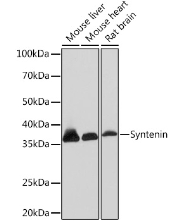Syntenin Rabbit Monoclonal Antibody