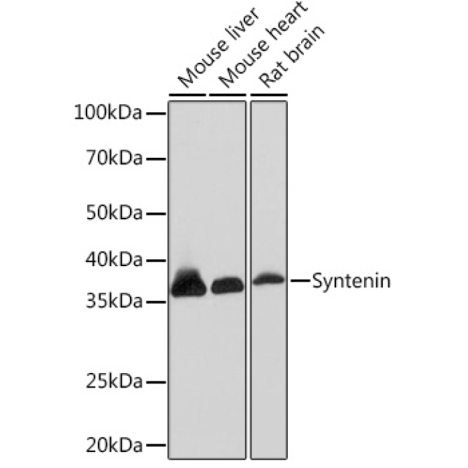 Syntenin Rabbit Monoclonal Antibody