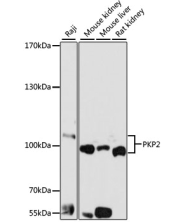 PKP2 Rabbit Polyclonal Antibody