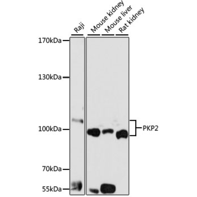 PKP2 Rabbit Polyclonal Antibody