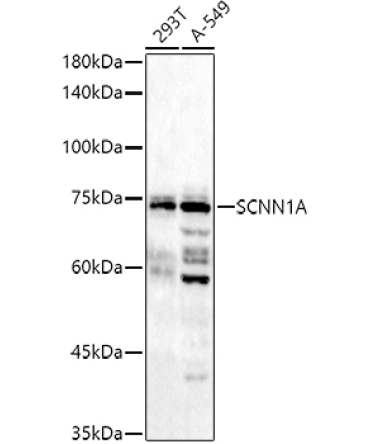 SCNN1A Rabbit Polyclonal Antibody