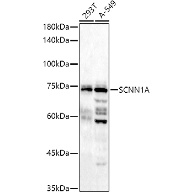 SCNN1A Rabbit Polyclonal Antibody
