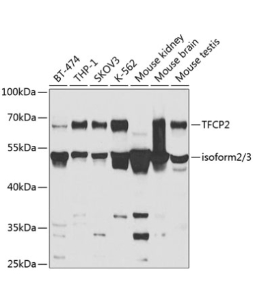 TFCP2 Rabbit Polyclonal Antibody