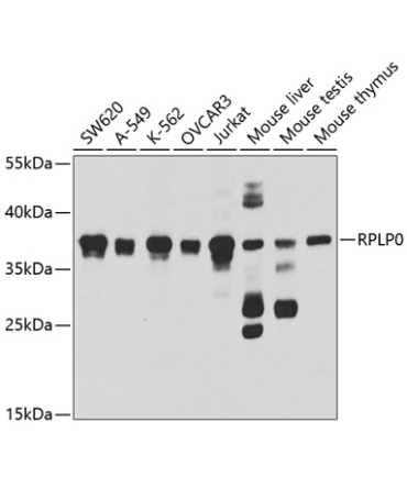 RPLP0 Rabbit Polyclonal Antibody