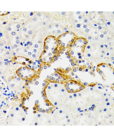 SH2B1 Rabbit Polyclonal Antibody