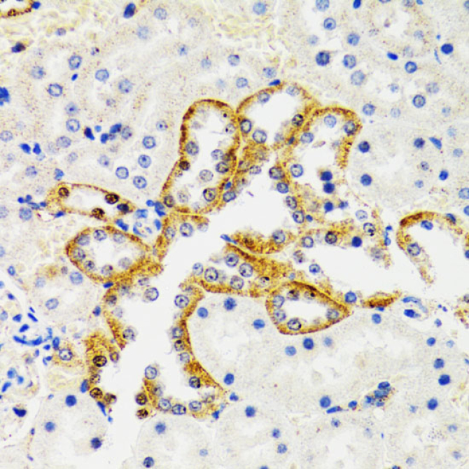 SH2B1 Rabbit Polyclonal Antibody