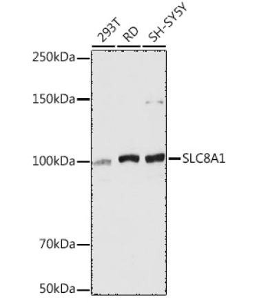 SLC8A1 Rabbit Polyclonal Antibody