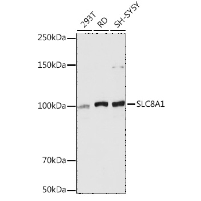 SLC8A1 Rabbit Polyclonal Antibody