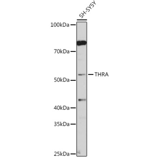THRA Rabbit Polyclonal Antibody