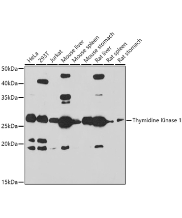 Thymidine Kinase 1 Rabbit Polyclonal Antibody