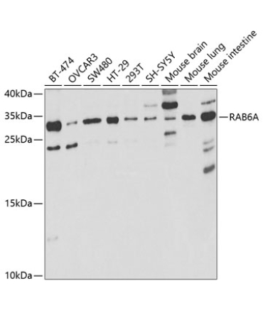 RAB6A Rabbit Polyclonal Antibody