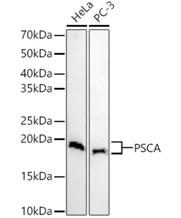 PSCA Rabbit Polyclonal Antibody